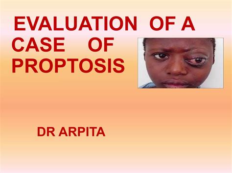 Evaluating Proptosis Causes and Approach | PPT