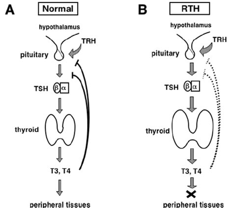 Negative Feedback Loop Thyroid