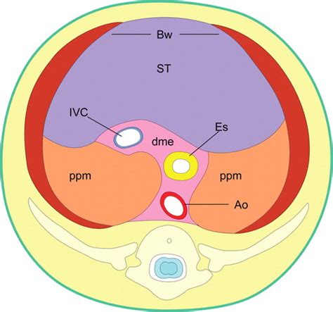 The Diaphragmatic Crura and Retrocrural Space: Normal Imaging Appearance, Variants, and ...