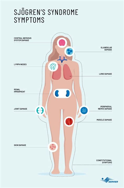 Sjogren's Syndrome: Symptoms, Causes, And Support, 49% OFF