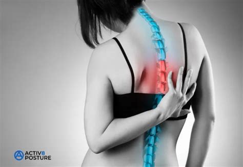 What Causes Thoracic Back Pain & What Are the Symptoms? - Activ8 Posture