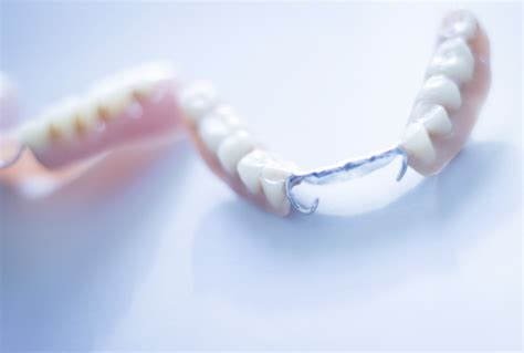 Do Partial Dentures Hurt | European Denture Center