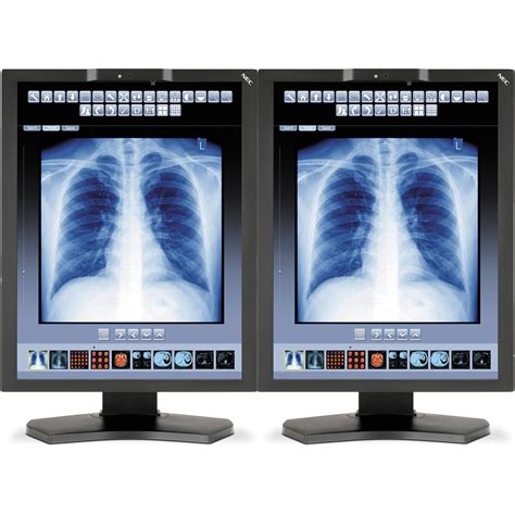 NEC 21" Color Medical Diagnostic Monitors MDC3-BNDA1 B&H