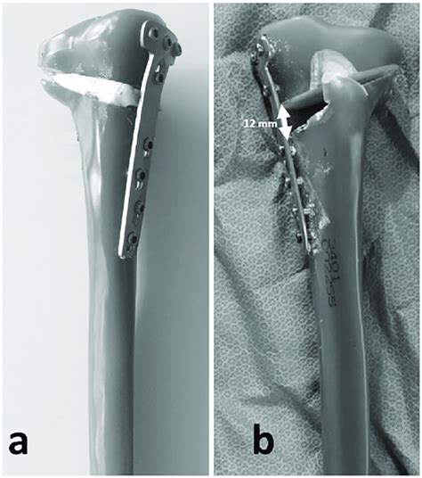 Example specimens from each group. (A) Allograft Group; (B) Control ...