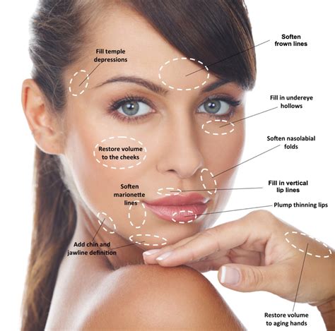 Dermal Fillers - Colleyville Dermatology