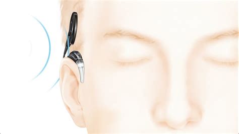 How the Cochlear™ Nucleus® implant system works - YouTube