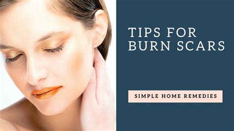 HOW TO REMOVE BURN SCARS (HOME REMEDIES) - YouTube