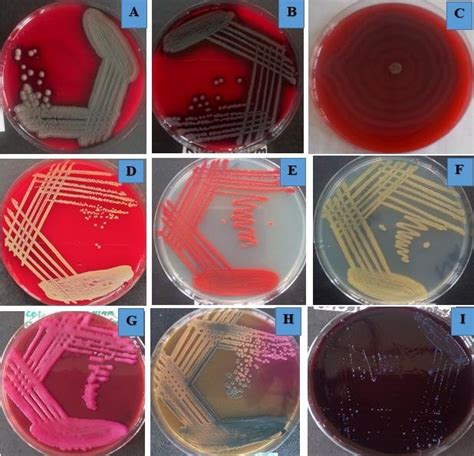 Plates showing colony morphology of some isolates in different culture... | Download Scientific ...