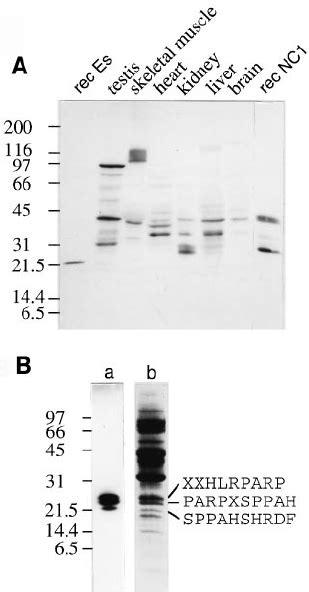 Immunoblot detection of endostatin in mouse tissue extracts ( A ) and... | Download Scientific ...