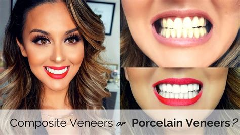 Composite or porcelain veneers? Which is the right option for you? | Zoom teeth whitening ...