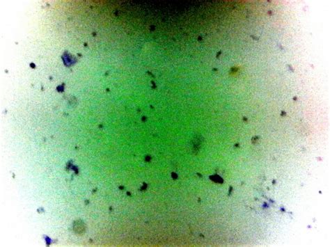 Bacteria (Human Mouth) Prepared Microscope Slide