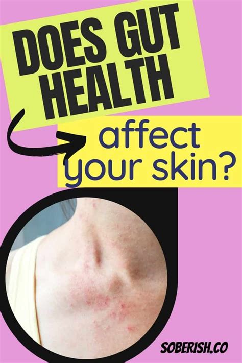 Can Gut Health Affect Your Skin? (Spoiler: YES!)