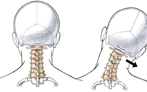 Pivot Joint Neck