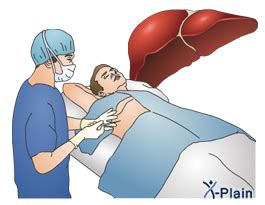 Percutaneous Liver Biopsy