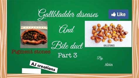 Gallbladder stones, pigment stones and there symptoms. - YouTube