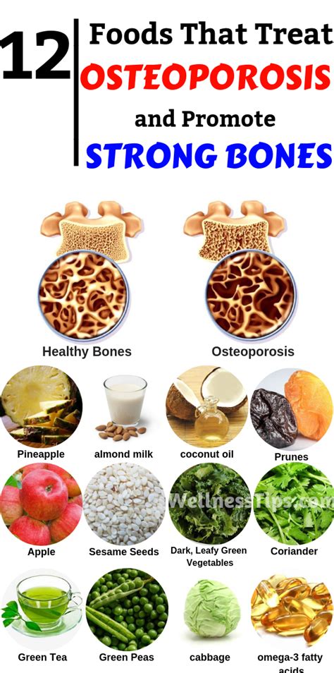 12 Foods That Treat Osteoporosis and Promote Strong Bones! | Diet and nutrition, Health food ...