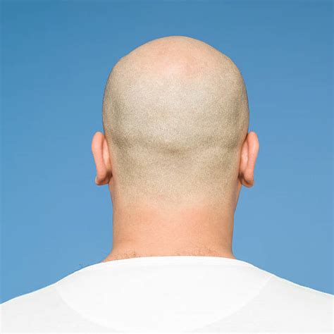 Back Of Head Completely Bald Shaved Head Balding Stock Photos, Pictures & Royalty-Free Images ...