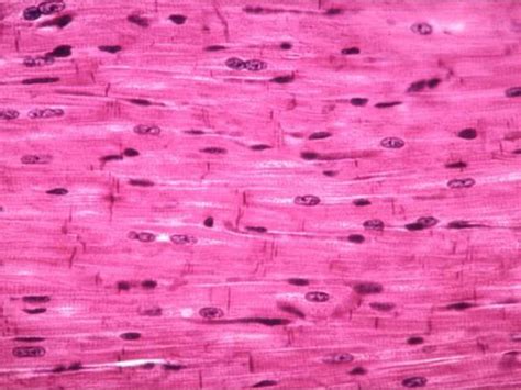 Heart (Cardiac Muscle): Microscope Slide Diagram | Quizlet