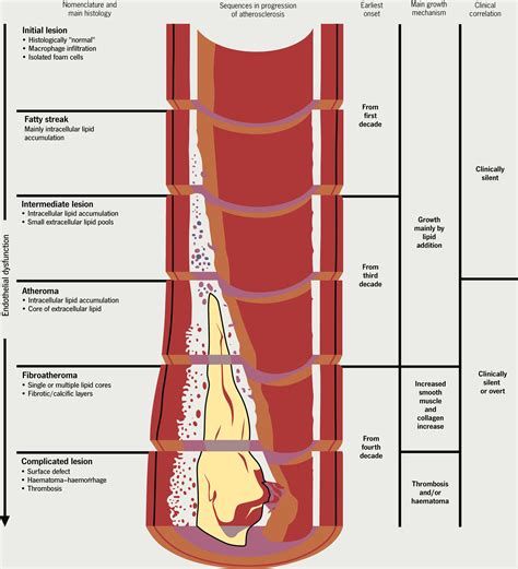 Lipids module 1: lipid metabolism and its role in atherosclerosis - The British Journal of ...