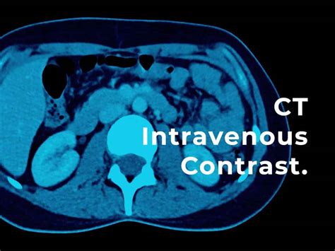 CT Scan with IV Contrast Patient Fact Sheet