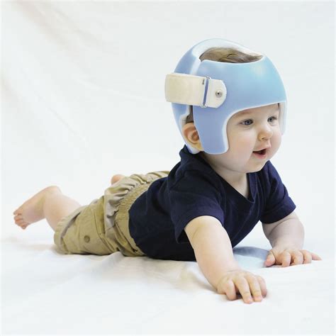 Steeper Clinic What Is Plagiocephaly? - Steeper Clinics