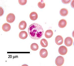 Why Are Eosinophilic Red and Basophils Blue He - Mohr Itand1980