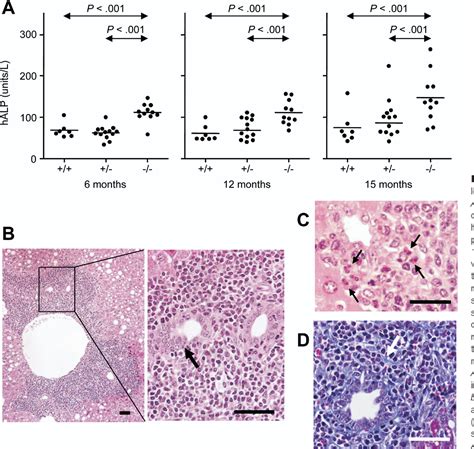 Antimitochondrial Antibody Measurement | Semantic Scholar