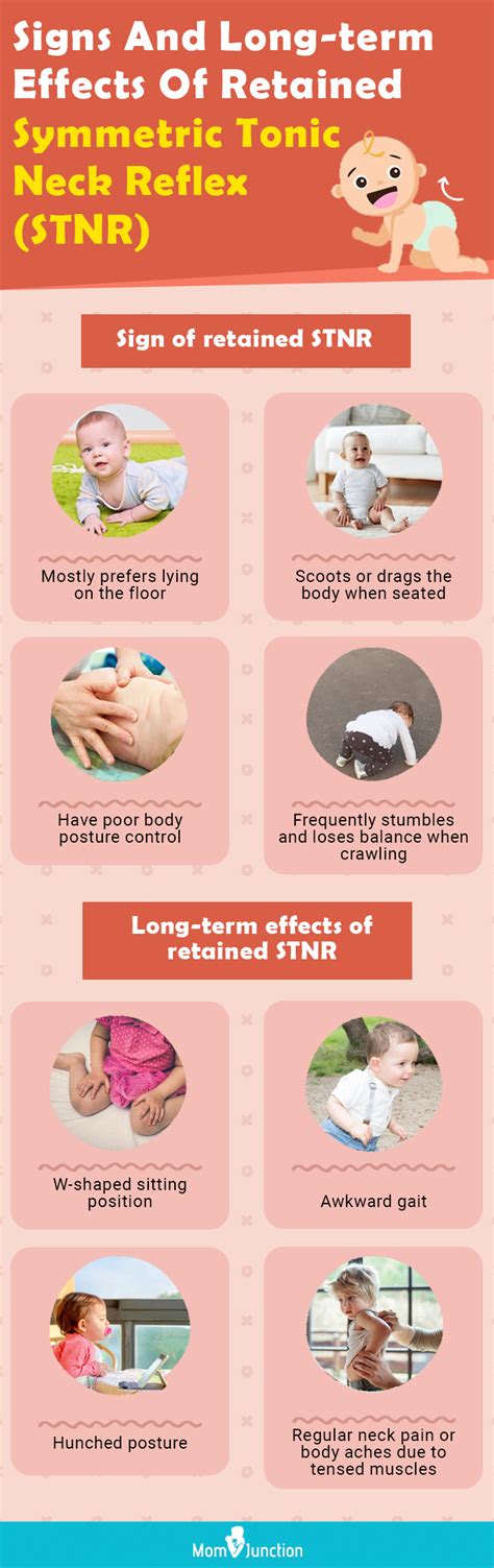 What Is Symmetric Tonic Neck Reflex In Babies?