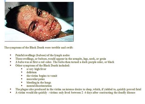 My Screencast: Black Death symptoms