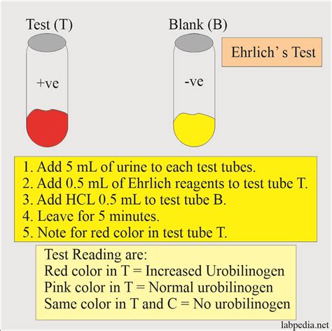 Urine for Urobilinogen