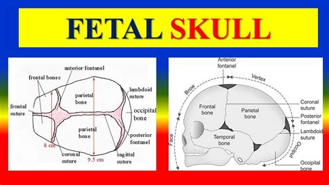 FETAL SKULL - Bones, Regions, Landmarks & sutures ,fontanelles ...