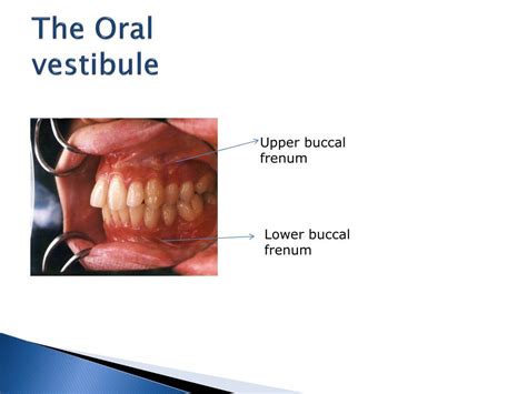 PPT - ORAL ANATOMY PowerPoint Presentation, free download - ID:2381675