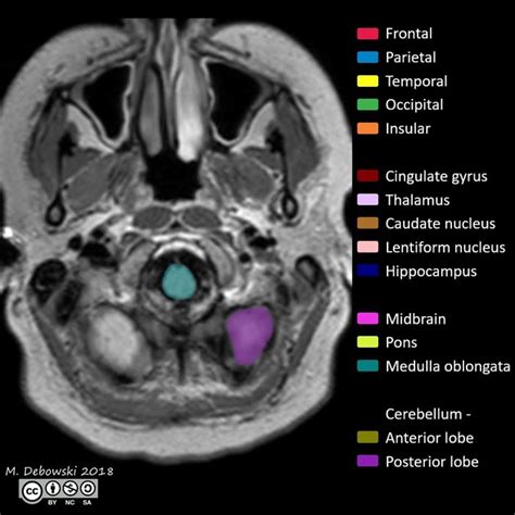 いいたしま Imaging Anatomy of the Head and Spaine E0Xbe-m13534347223 があり