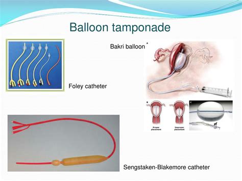 What are foley catheters used for: What Is Foley Catheter Used For ...