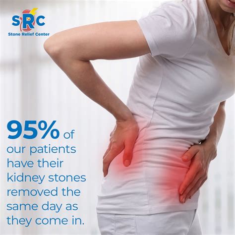 Local Houston Clinic Offers New Approach For Kidney Stone Treatment ...