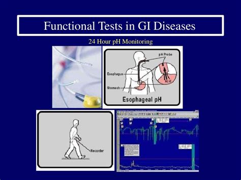 Gastro intestinal system diagnostic-tests-