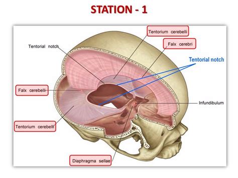 DEMO – V (Meninges and CSF) - ppt video online download | Facial nerve, Basement membrane ...