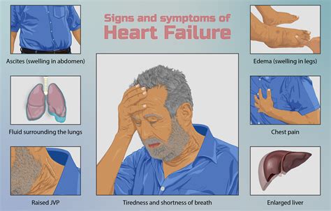 Systolic Heart Failure vs Diastolic Heart Failure: Symptoms, Diagnosis, Treatment, and Prognosis ...