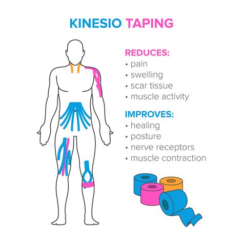 All about kinesiology taping!