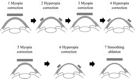 Frontiers | Hyperopia-Correcting Phototherapeutic Keratectomy and Its Comparison With ...