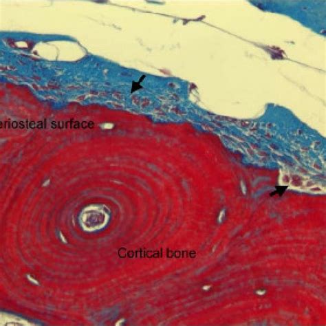 (PDF) The periosteum. Part 1: Anatomy, histology and molecular biology