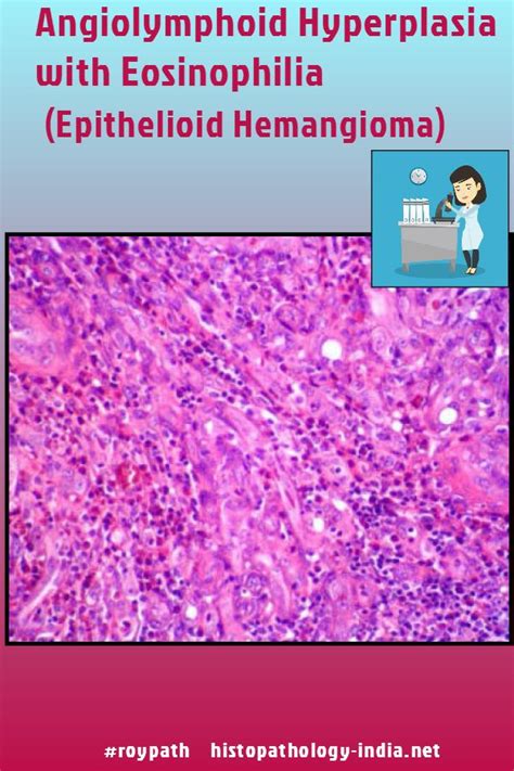 Pin on Dermatopathology and Soft Tissue Pathology