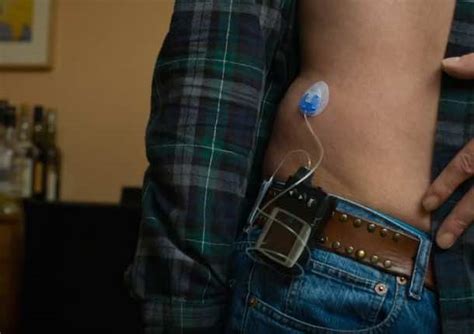 Artificial Pancreas Will Soon Be A Reality - Wonderful Engin