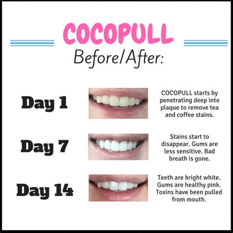 Coconut Oil Pulling Benefits Brighter, Whiter Teeth - helps remove coffee and tea stain ...