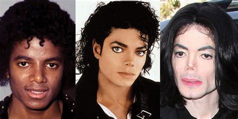 Michael Jackson Plastic Surgery Before and After Pictures 2024