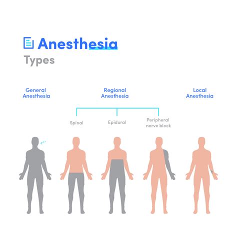 MediMagic - What are the types of anesthesia? 1. General... | Facebook