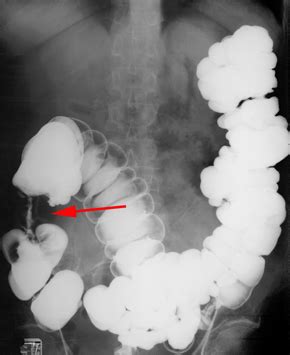 Gastrointestinal Radiology