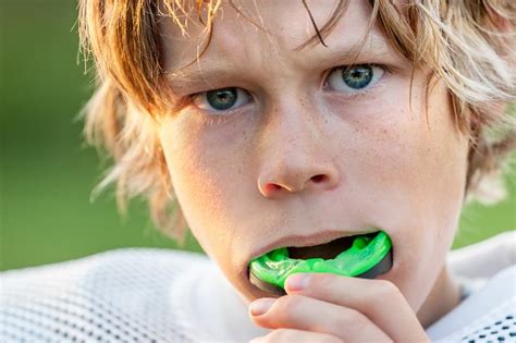 Best Mouthguard for Braces – Frisco | RxSmile Frisco Orthodontist | Frisco Invisalign Provider