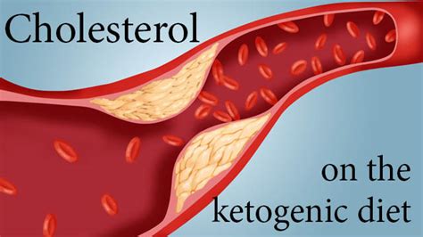 Cholesterol On the Ketogenic Diet - Maria Mind Body Health