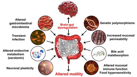 What Causes IBS and the Surprising Bowel-Bladder Connection - TYE Medical